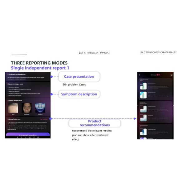 GMS- A6 Al Intelligent Face Analyzer Machine 15 Skin Problems Analysis Made Easy with 8 Spectral Imaging Technologies