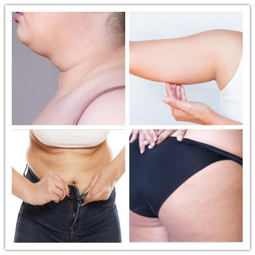 Burning Fat Lipolytic Solution 10ml Lose Weight Injection