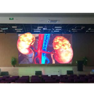 Customized Virtual Three Dimensional Interactive Teaching 3D Display Screen