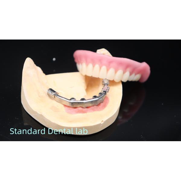 Quality Titanium Implant Supported Dentures Precise Ivoclar Denture Over Implants for sale