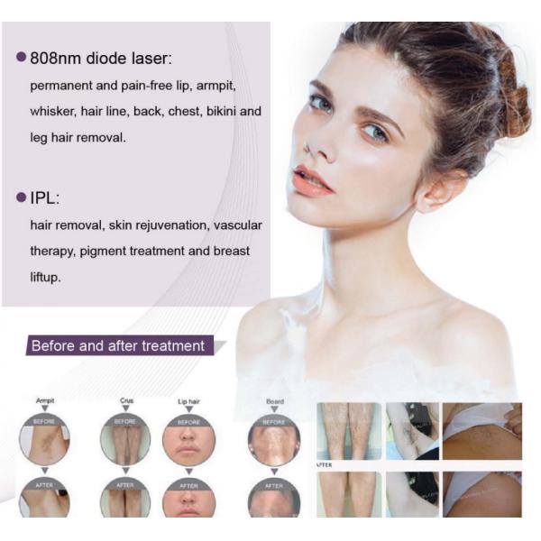 808nm Commercial ipl diode Laser Hair Removal Machine With Big Spot Size 13×13mm2
