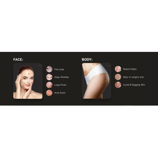 Fractional Micro Needle Vacuum RF Machine RF Vacuum Lifting Microneedling Machine