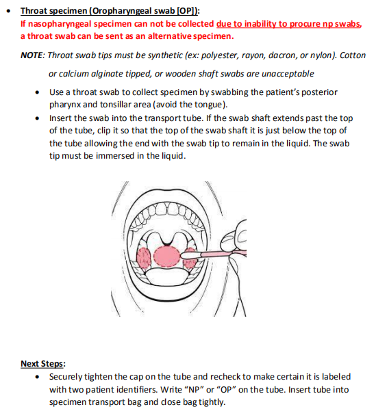 150mm Disposable Sampling Swab , Medical PCR Test Throat Swab