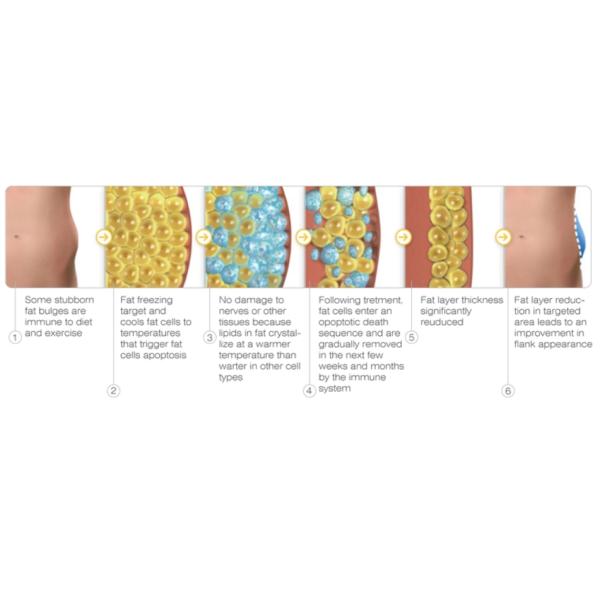 bottom price vertical cryolipolysis far freeze slimming machine /best effective cavitacion rf