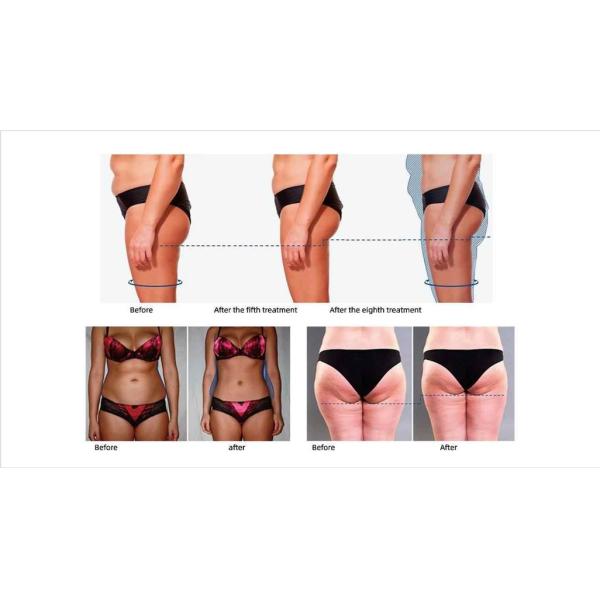 300 - 4000w Tesla EMS Machine Electromagnetic Body Sculpture Slimming Machine 150Hz