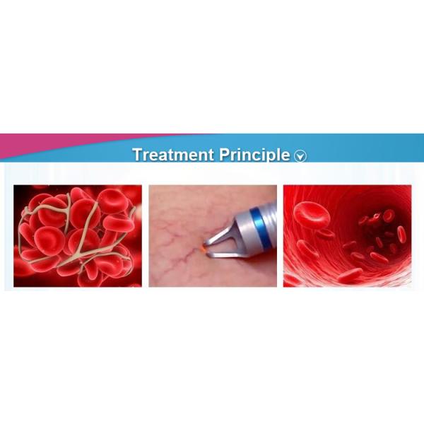 Professional 9 spot diode vascular laser 980 nm diode laser vein removal machine for sale