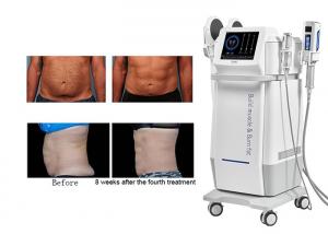 China OEM Electromagnetic Muscle Building Machine Professional Fat Burning Machine on sale