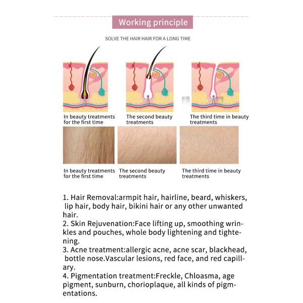 Skin Tightening Optical Ipl Hair Removal Machine 610nm Multi Pulse