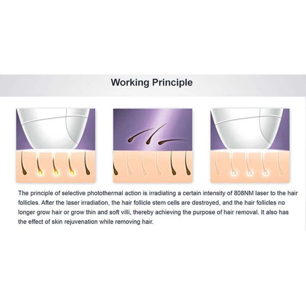 Compact and Efficient Portable Diode Laser Hair Removal Device for Professional Clinics