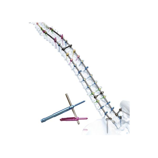 Minimally Invasive Surgery Polyaxial Pedicle Screw For Orthopedic Spine Implant