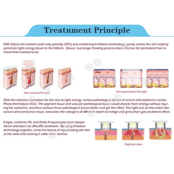 Skin rejuvenation shr elight hair removal machine OEM ODM best treatment result