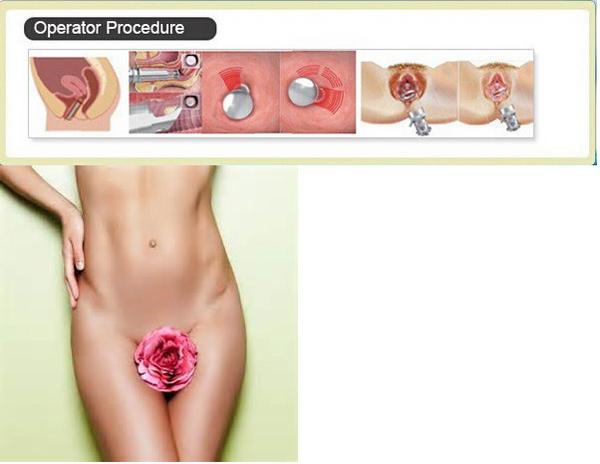 co2 dot laser smartskins co2 laser ablation best anti aging technology laser resurfacing machine