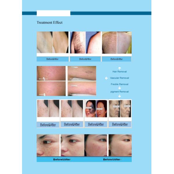 1800W Multifunctional Beauty Machine Hair Removal With IPL RF ND YAG Laser
