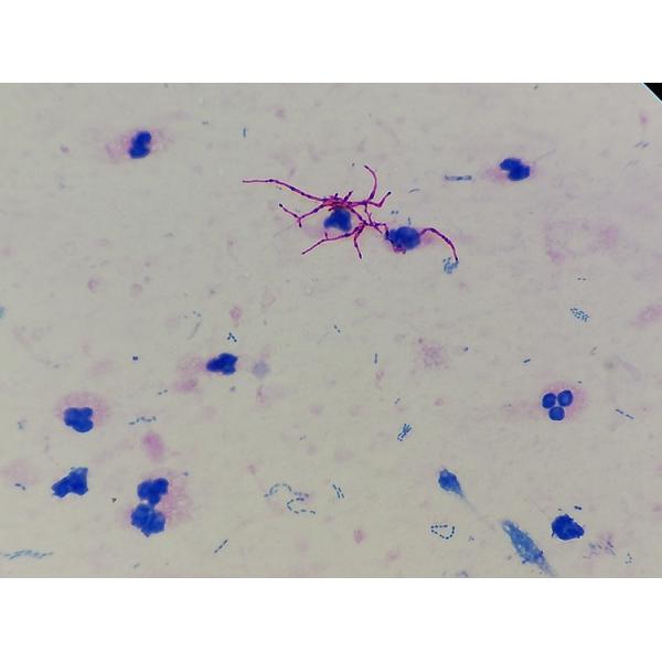 Weak Acid Fast Stain Reagents 4x100ml For Clinic / Research Institution