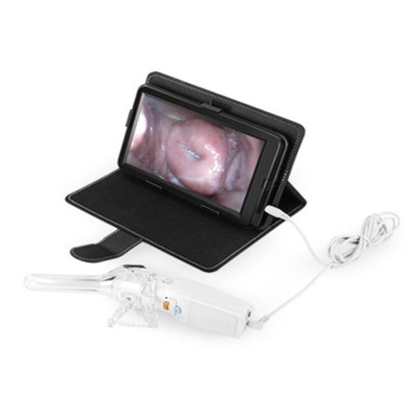 High Definition Display AV / USB Output Vaginal Probe Digital Electronic Colposcope