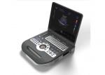 Color Doppler Ultrasound Machine Ultrasound Medical Equipment With 5 Kinds
