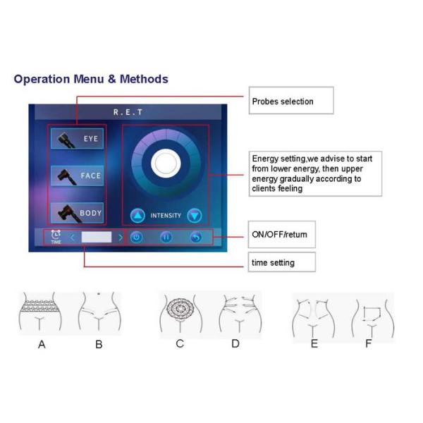High Frequency Cavitation Rf Slimming Machine Fast Fat Burning With Direst Results