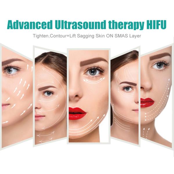 HIFU Skin Tightening Machine with Time Difference Protection