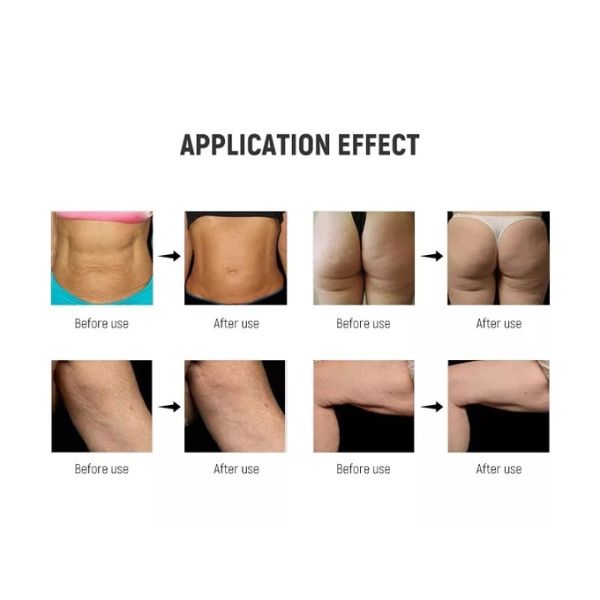 4 In 1 Ultrasonic Cavitation Machine 80k Body Shaping RF Cavitation Slimming Machine