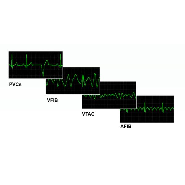 criticare patient monitor Aurora 8S 8.4-inch lightweight semi-modular criticare patient monitor for ambulance