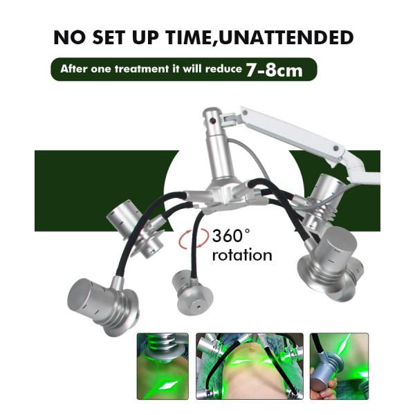 532nm laser