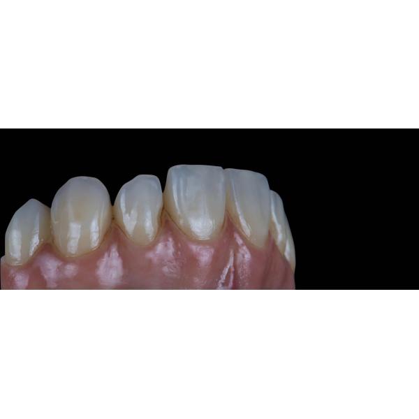 D98 Open System Zirconia Blocks Upcera 4D Explore