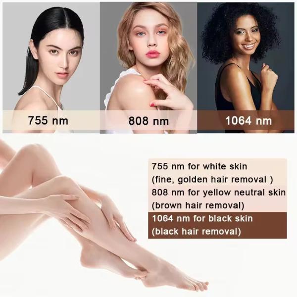 LZR Portable Diode Laser Hair Removal Machine With Adjustable Pulse Duration