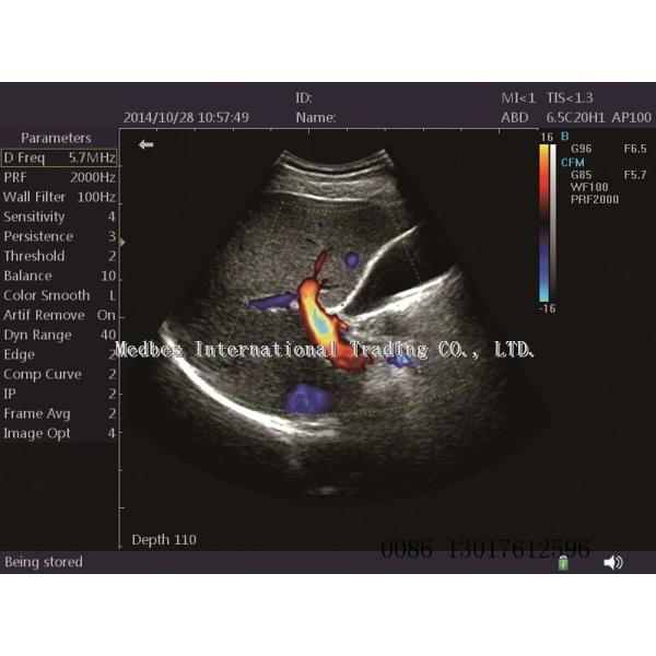 two probe holders Portable 2D Color doppler ltrasound Scanner human ultrasound machine