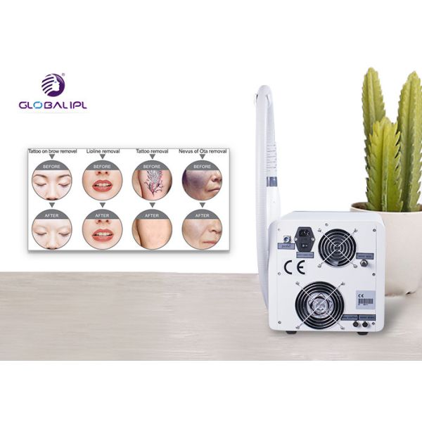Tattoo Removal Q Switched Nd Yag Laser 1 To 6Hz Frequency 220V / 110V Voltage