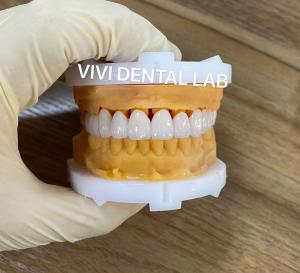China CE Dental Tooth Crowns Nickel Beryllium Free VIVI Dental Laboratory on sale