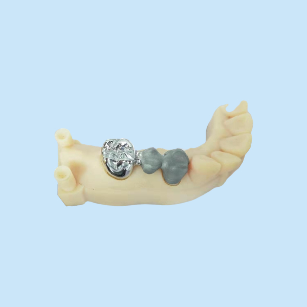 Customized Digital All Metal FCC crowns & bridges Nickel Chromium