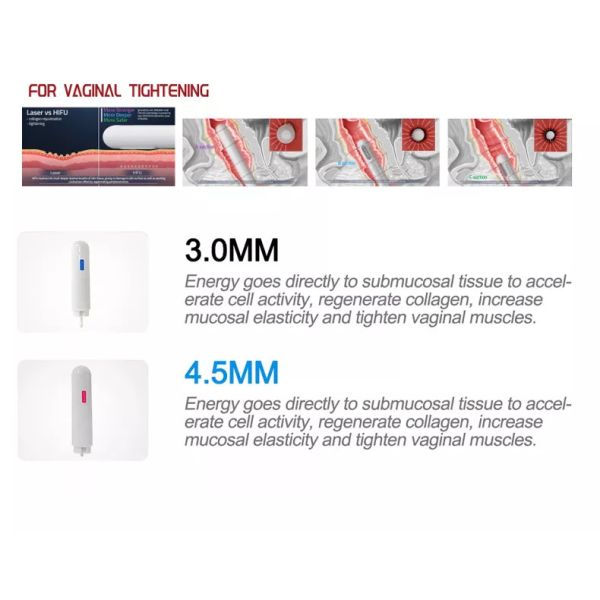 Women Hifu Beauty Machine For Vaginal Tighten 360 Degree Rotating