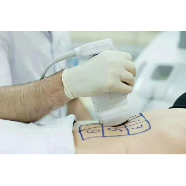5Mhz Rf Frequency Slimming Machine with Three Handles and Weight Loss Feature