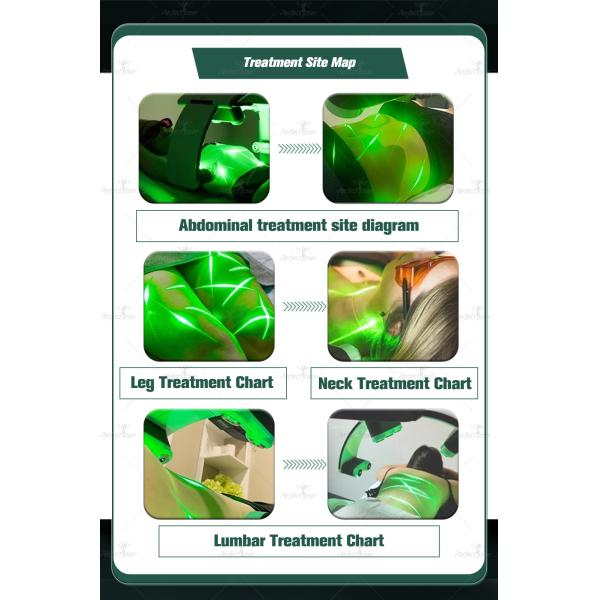 Slim Master 10d EMerald Lipo 532nm Diode Green Laser Body Slimming Fat Removal No Pain Cellulite Reduce Machine