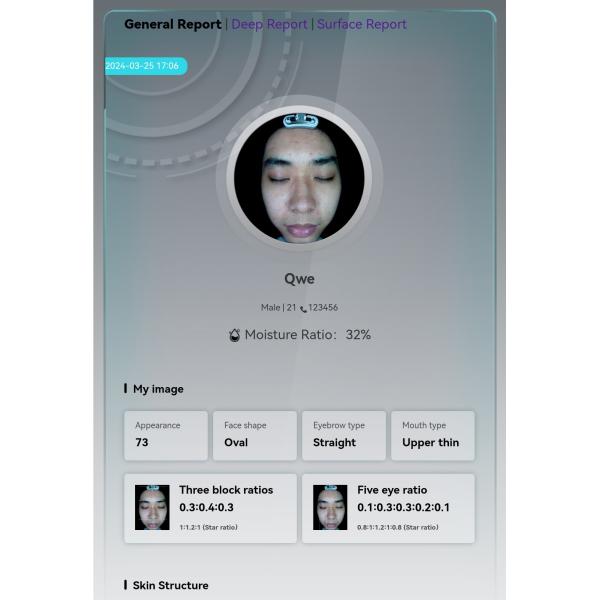 Portable 3d Skin Analysis Machine Skin Analysis 3D AI Facial High-Definition Skin Testor