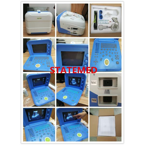 10 Inch Portable Sonogram Machine / 80E Element Ultrasound Imaging Machine