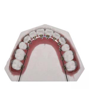 China Straight Wire Fixed Orthodontic Appliances For Teeth Straightening on sale