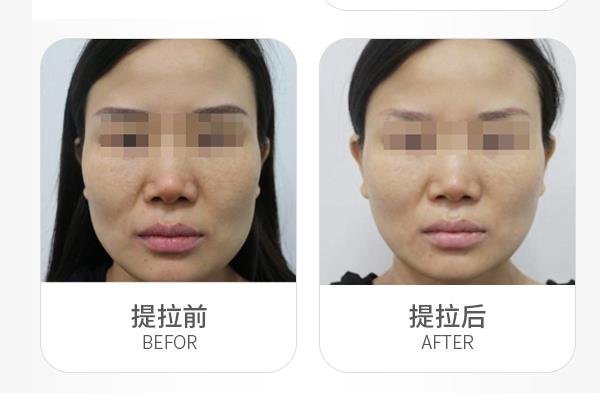 Personal 15W Portable Radio Frequency Machine , PSE Radio Frequency Beauty Device