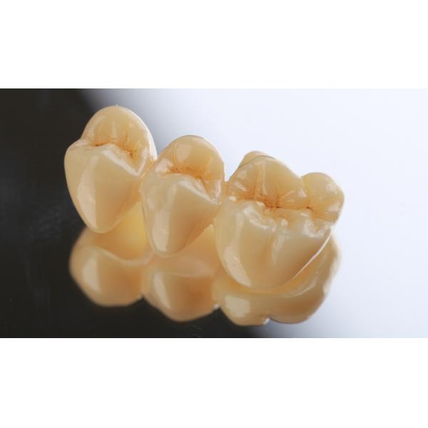 High Translucent 3.1g/cm3 Pre Shaded Zirconia Discs Open System
