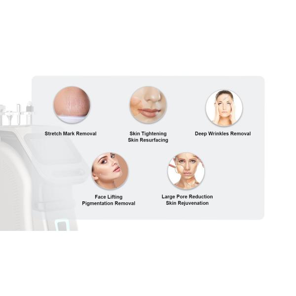 Professional vertical radio frequency microneedling Remove Stretch marks rf skin tightening machine