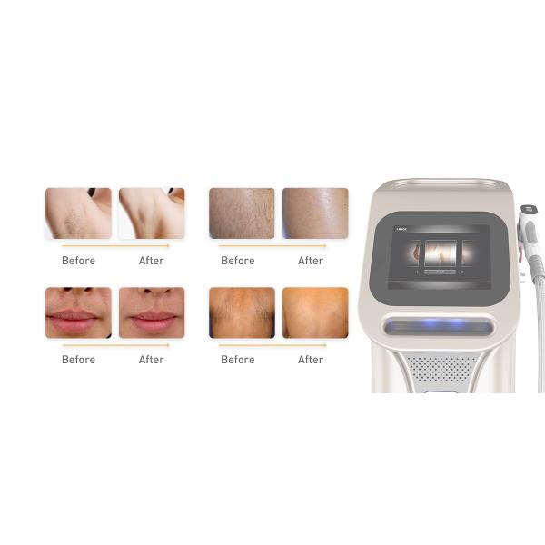 Ice Platinum 2000W 808Nm Diode Laser System Professional Painless Permanent Laser Hair Removal Machines