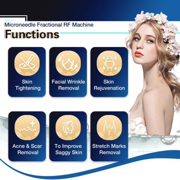 Microneedle RF Stretch Marks Removal Machine Fractional Skin Rejuvenation