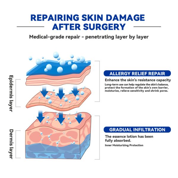 Sterile Chitosan Wound Dressing Mask for Post Laser Recovery and Aesthetic Repair