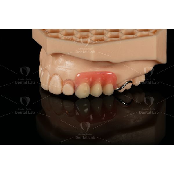 Lightweight Cobalt Chrome Partial Denture Framework Clasp Flexible Acrylic Partial Denture