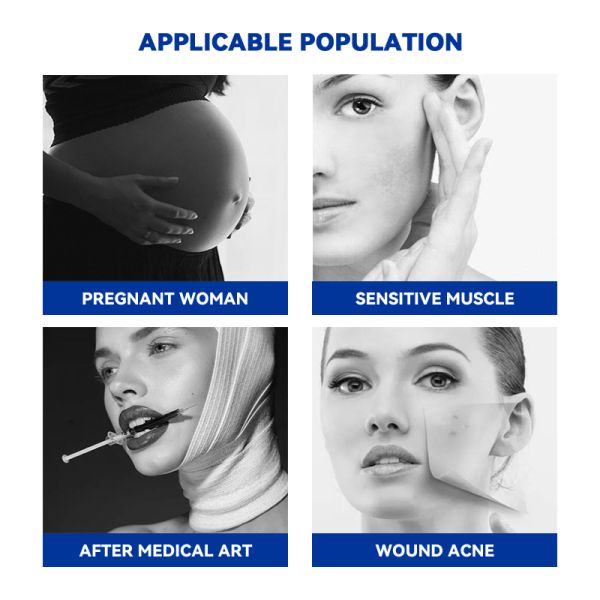 Sterile Chitosan Wound Dressing Mask for Post Laser Recovery and Aesthetic Repair