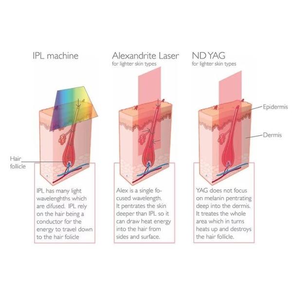 CE Approved Vertical Shr Ipl Machine For Beauty Salon