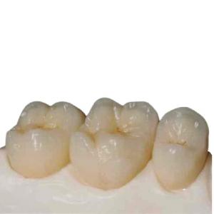 Buy cheap High Strength Zirconia Ceramic Teeth Precision Digitally Manufactured product