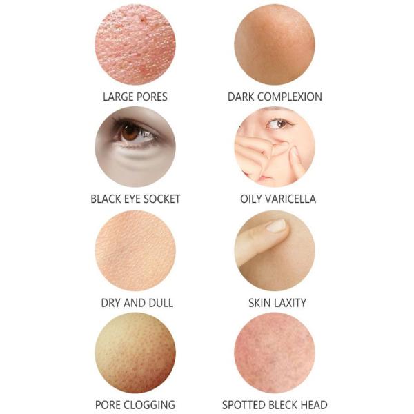 Home Use 7 In 1 Oxygen Microdermabrasion Machine Facial Beauty