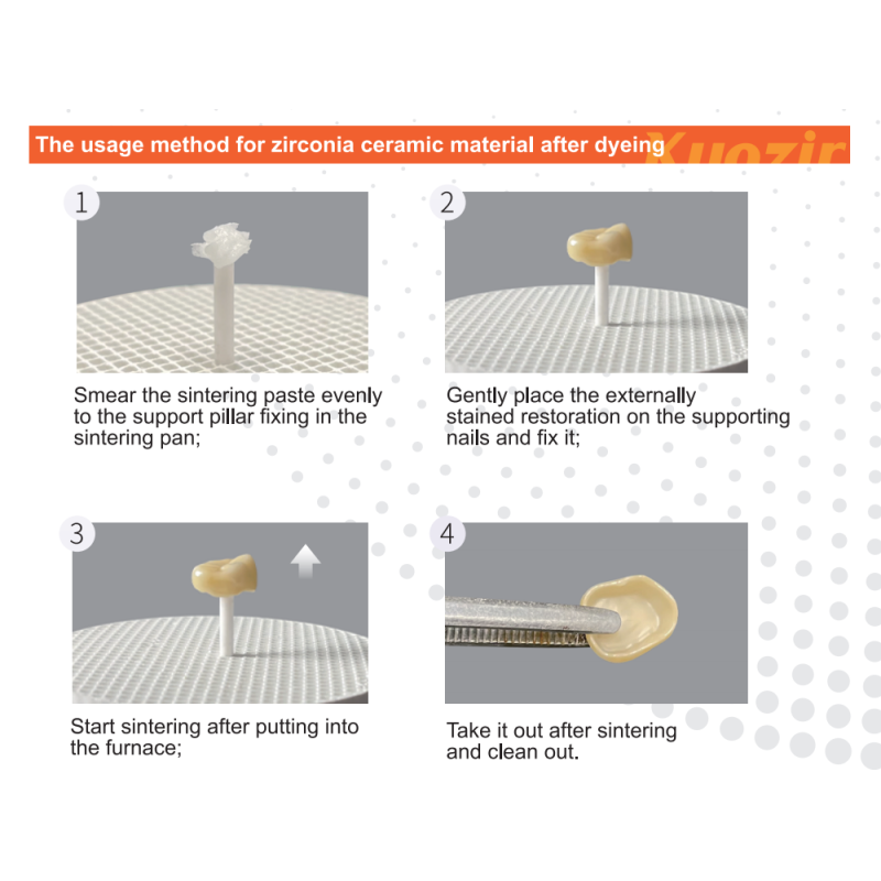 CAD CAM Compatible Firing Paste Dental Laboratory Zirconia Sintering Support Digital Workflow Integrated Medium