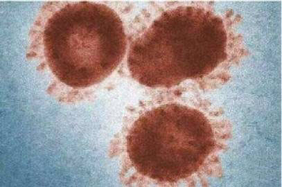 KSD9700 250V 5A 55 Deg C Bimetal Thermal Switch For 2019- NCov Tester